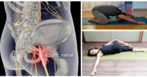 Sciatica was my nightmare for many years. Then the doctor recommended these exercises and since then, nothing!