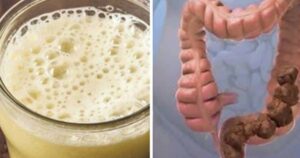 Effective body detox: Try these methods recommended by doctor Stanley Burroughs