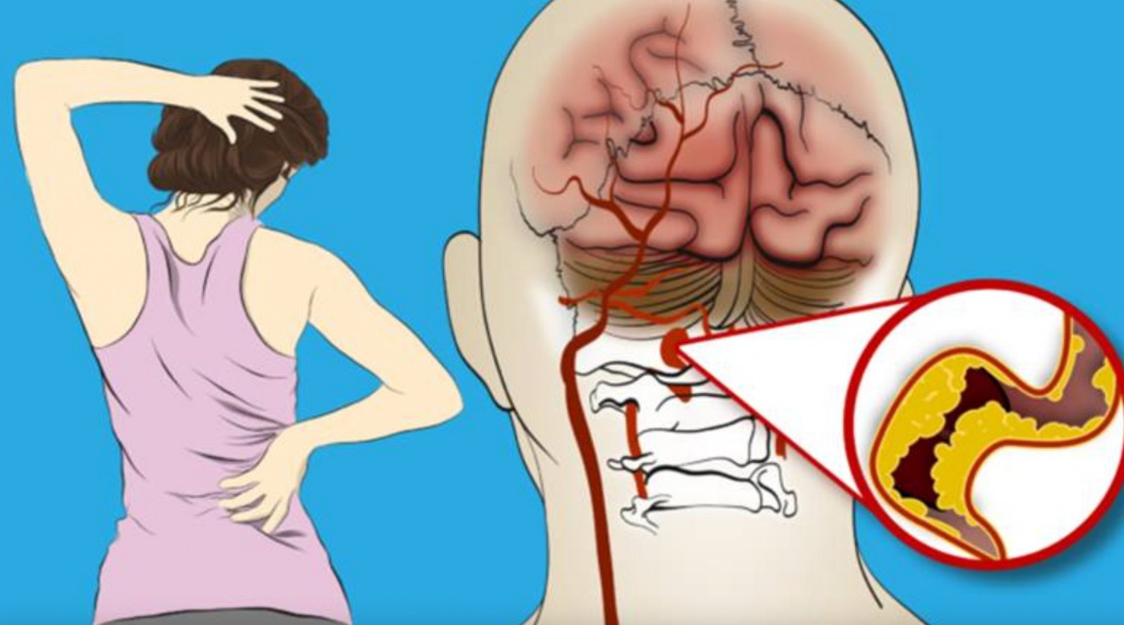 Warning signs that alert the body before the onset of a heart attack