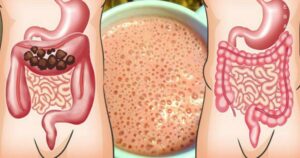 I used to go to the toilet once every 4 days. But then I discovered this intestinal "peeling" and the constipation disappeared!