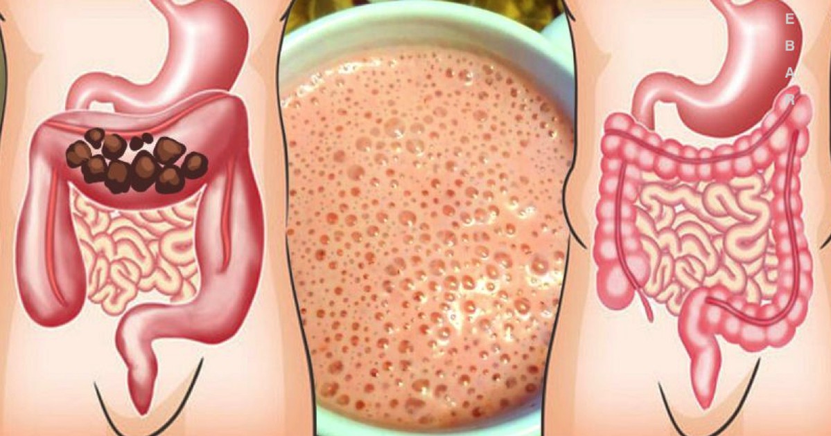 I used to go to the toilet once every 4 days. But then I discovered this intestinal "peeling" and the constipation disappeared!