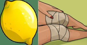 A home remedy that will remove fluid from the knee within 4 days. The painful swelling will disappear and you won't have to see a doctor!