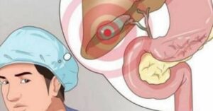 I was troubled by recurring abdominal pain. After a long time the doctor found that the cause was the gallbladder. Don’t ignore abdominal pain.