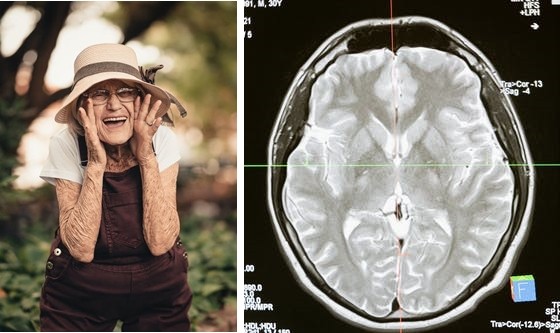 My wife is already over 80 years old, but her memory and brain work perfectly. This is her trick.