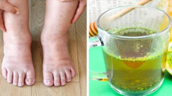 Parsley tea for swelling: An effective and natural remedy that will help you